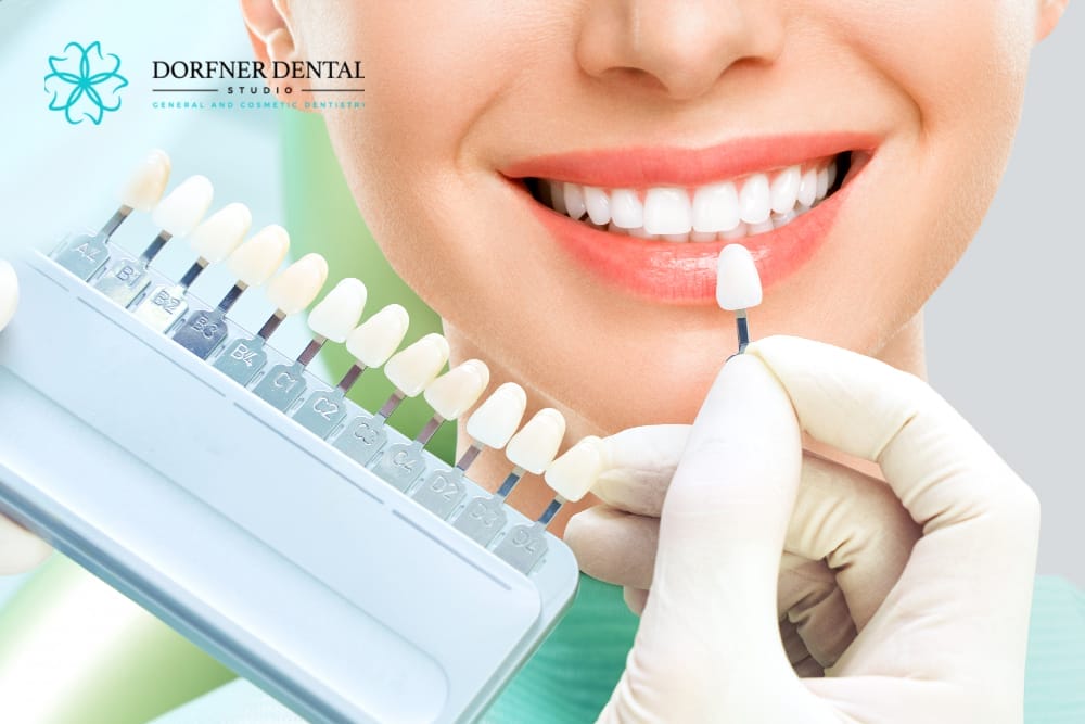 A dentist holding a shade guide next to a female patient's teeth to match the perfect veneer color, with the Dorfner Dental Studio logo in the corner.