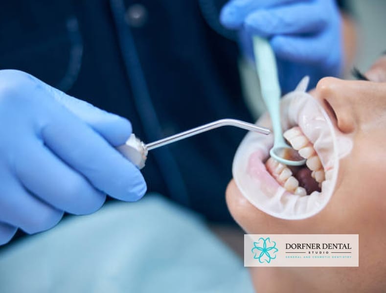 A dental professional performing a cleaning or procedure on a patient's teeth, with the Dorfner Dental Studio logo in the corner.