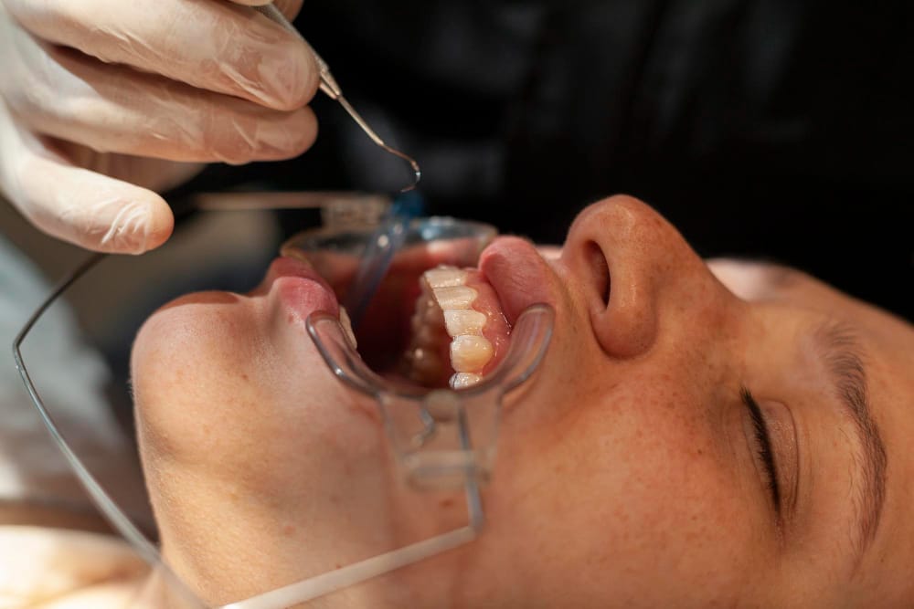 Dental professional conducting an oral examination as part of a full mouth reconstruction, assessing teeth alignment, gum health, and overall restoration needs.