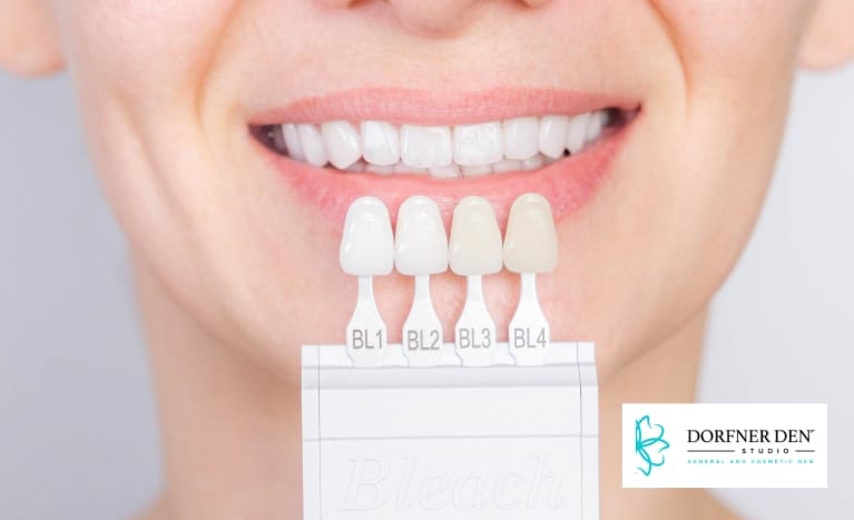 Close-up of a woman smiling while holding a teeth whitening shade guide in front of her mouth at Dorfner Dental Studio